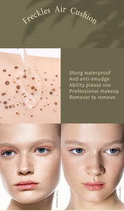 SkinSparkle® Face Freckle
